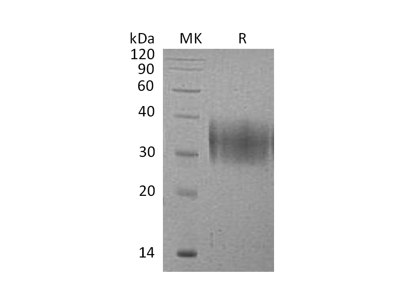 Recombinant Mouse VISTA (C-6His)