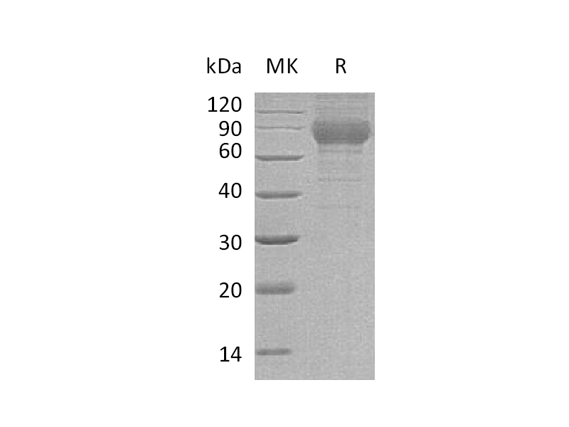 Recombinant Mouse PLXDC2 (C-6His)
