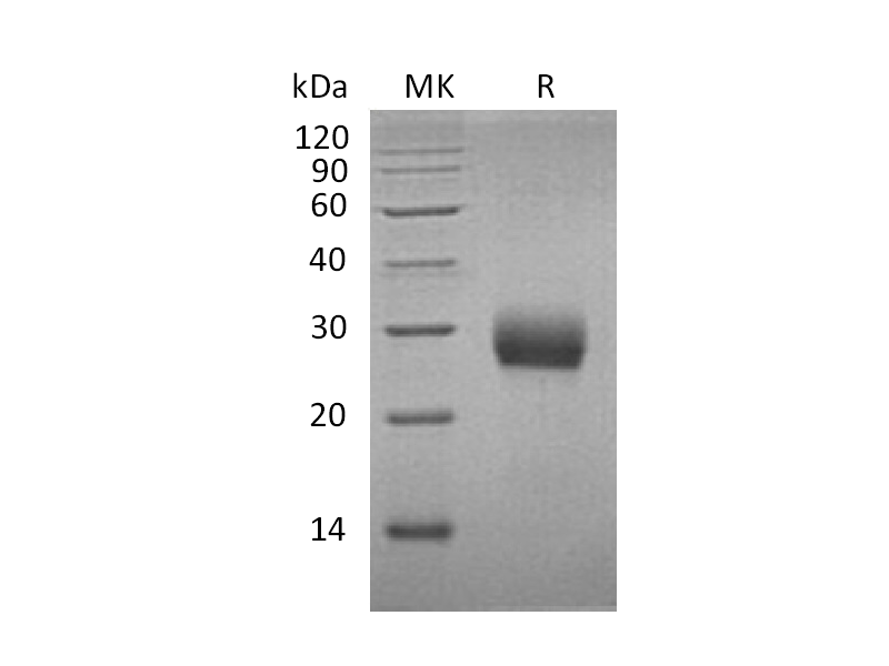 Recombinant Mouse RANK (C-6His)