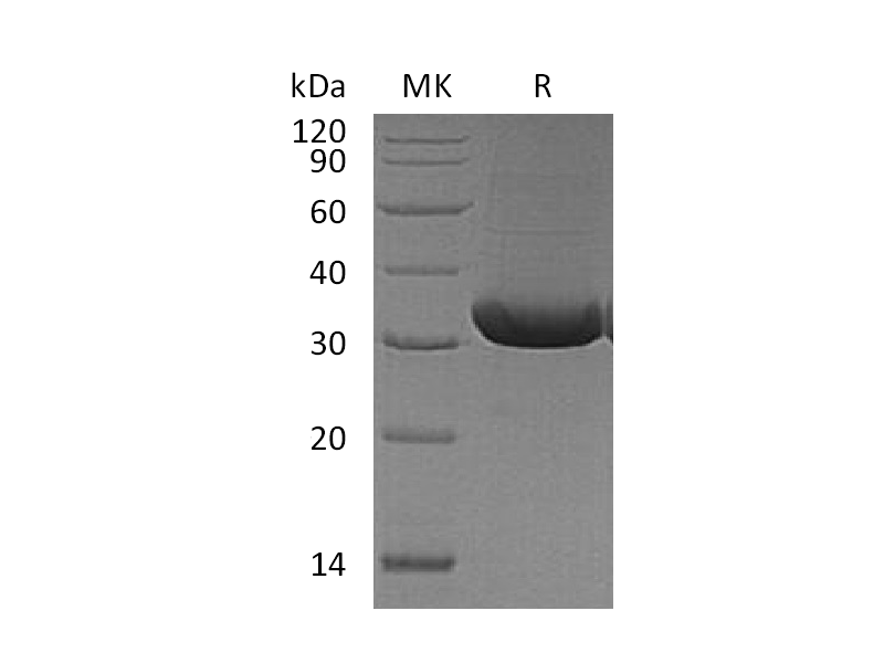 Recombinant Mouse RANK L (N-6His)