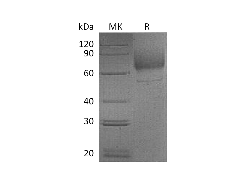 Recombinant Mouse LIMPII (C-6His)