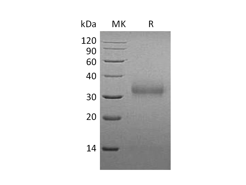 Recombinant Mouse SOST (C-6His)
