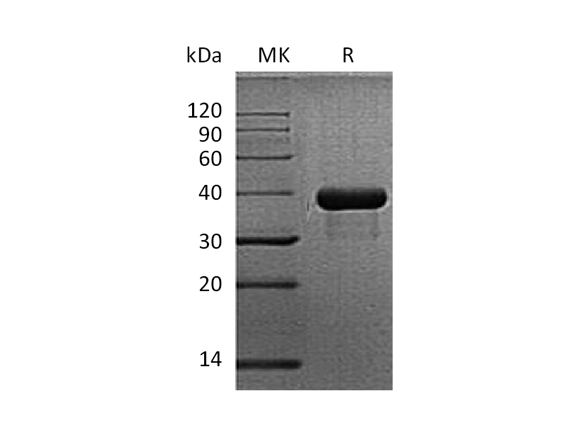 Recombinant Mouse SPARC (C-6His)