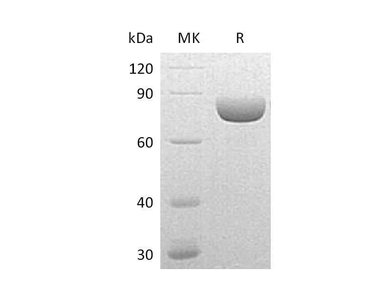 Recombinant Mouse SEMA4A (C-6His)