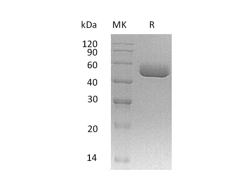 Recombinant Mouse Serpin A1a (C-6His, AAC28869.1 )