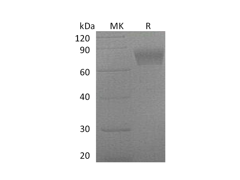 Recombinant Mouse Serpin F2 (C-6His)