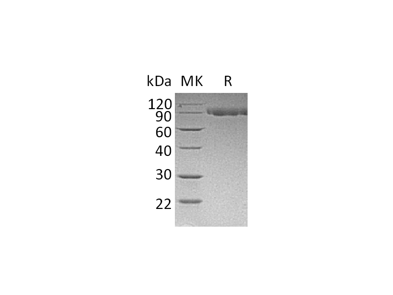 Recombinant Mouse Serpin G1 (C-6His)