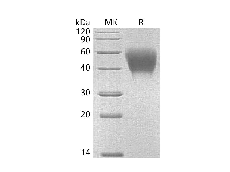 Recombinant Mouse SLAMF1 (C-6His)