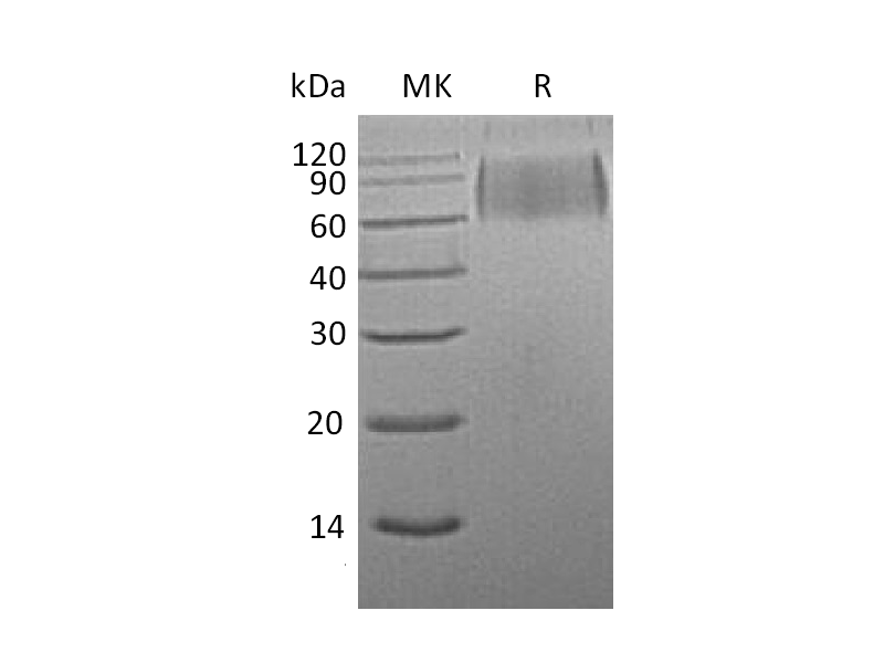 Recombinant Mouse SIRPA (C-6His)