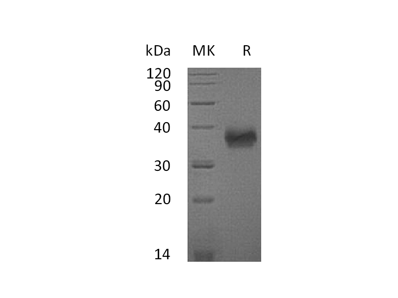 Recombinant Mouse SLAMF5 (C-6His)
