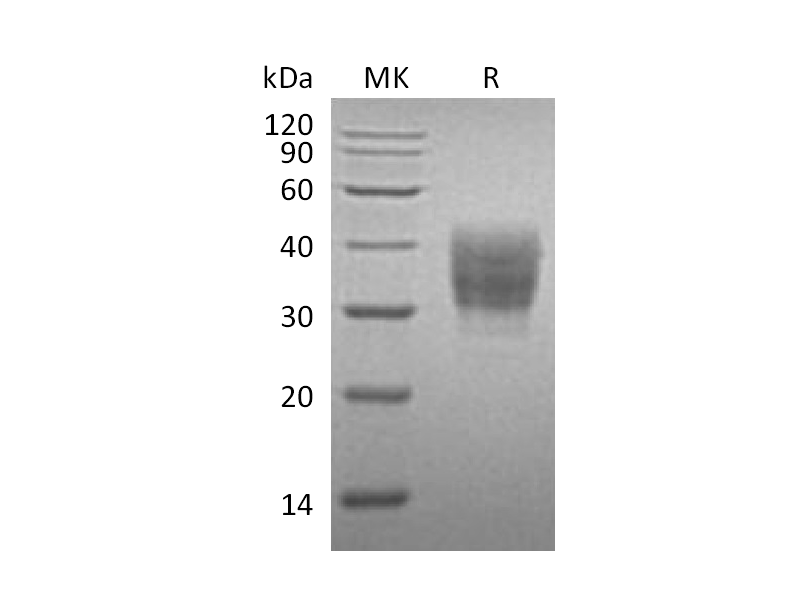 Recombinant Mouse SLAMF7 (C-6His)