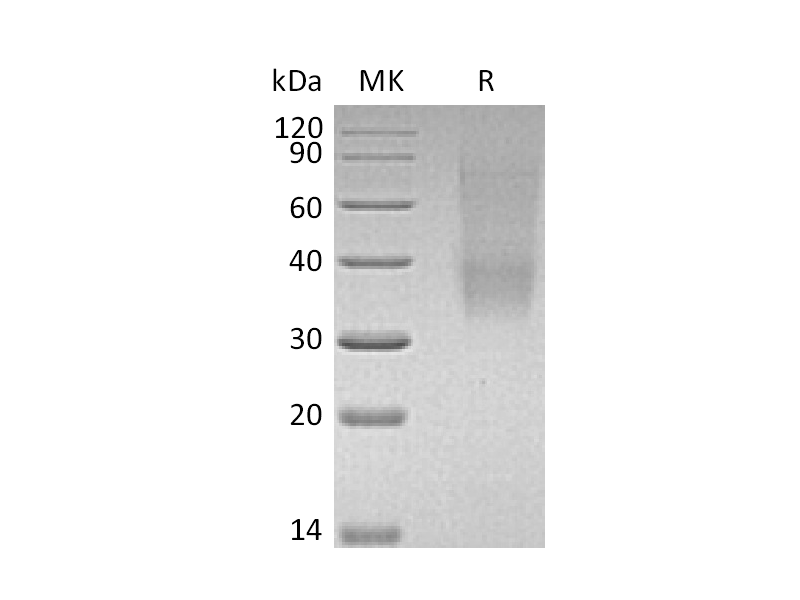 Recombinant Mouse SLAMF9 (C-6His)
