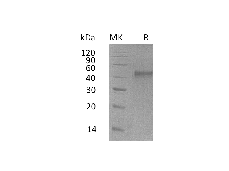 Recombinant Mouse ST6GalNAc2 (C-6His)
