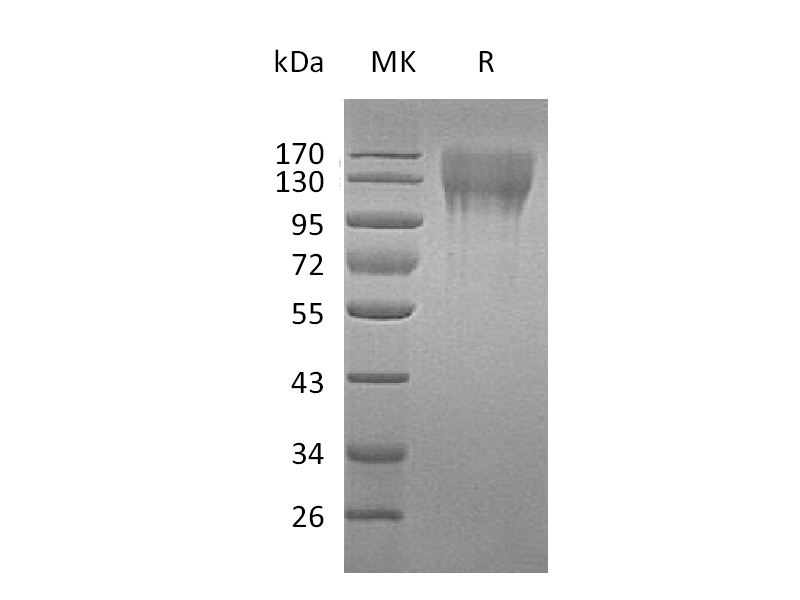 Recombinant Mouse CD96 (C-6His)