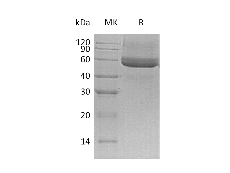 Recombinant Mouse Testican 3 (C-6His)
