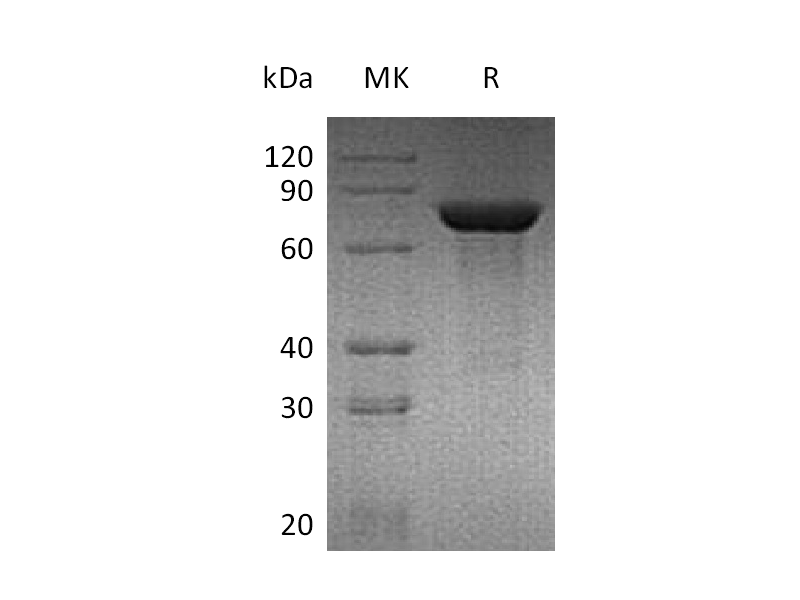 Recombinant Mouse TGM2 (C-6His)