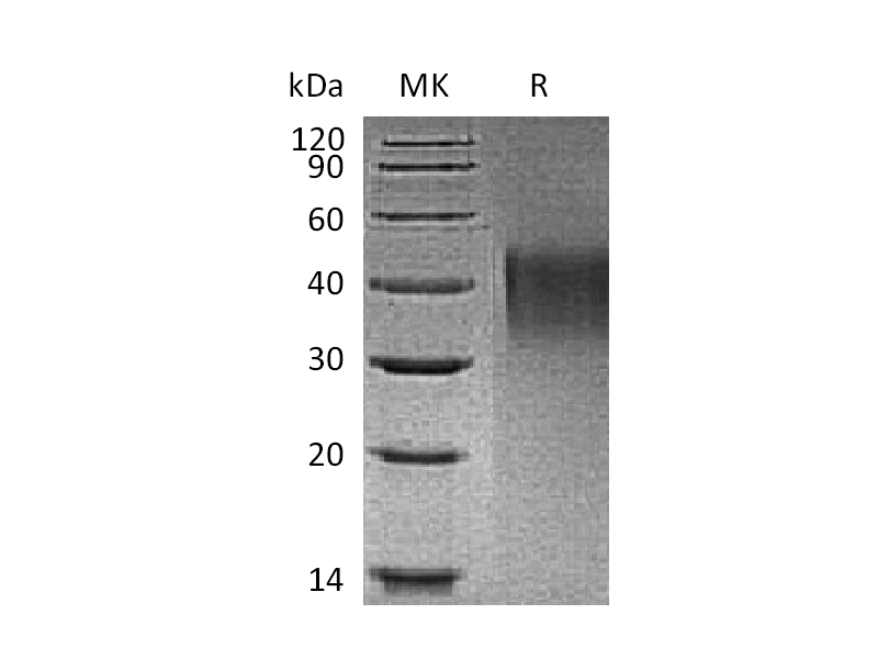Recombinant Mouse TIM-1 (C-6His)