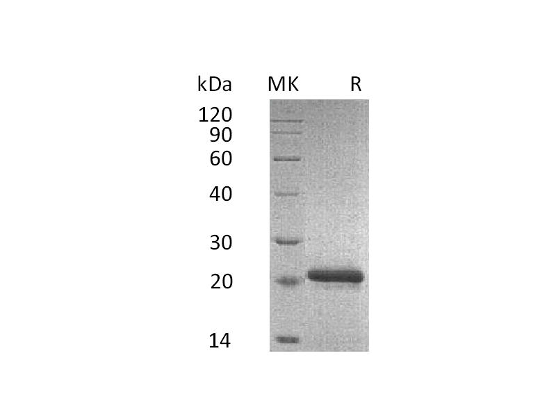 Recombinant Mouse TIMP-2 (C-6His)