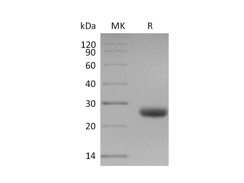 Recombinant Mouse TIMP-1