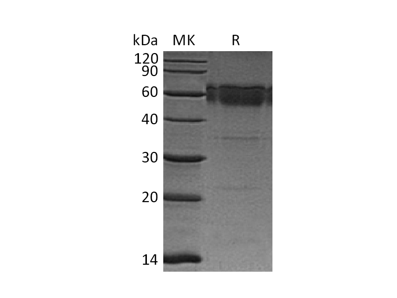 Recombinant Mouse TRAIL R2 (C-Fc)