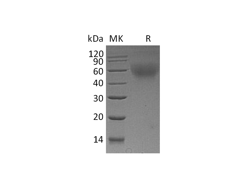 Recombinant Mouse CD30 (C-6His)