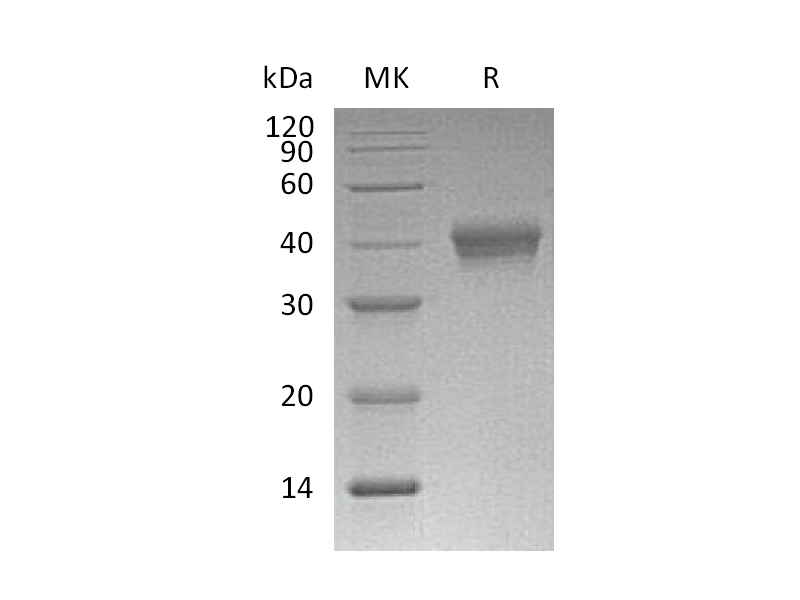 Recombinant Mouse CD38 (C-6His)