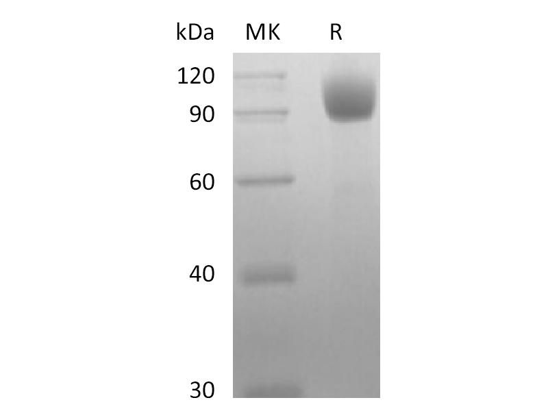 Recombinant Mouse ACE-2 (C-10His)
