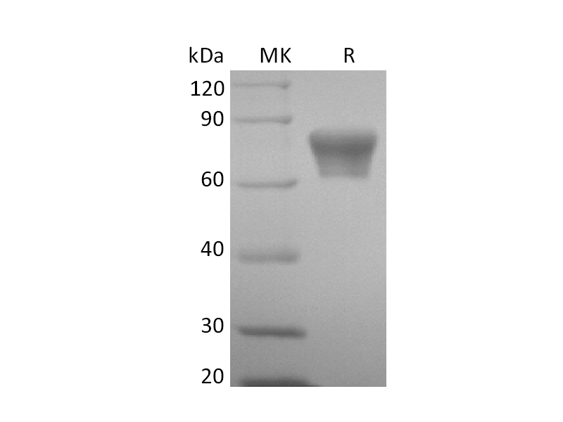 Recombinant Mouse TNF RII (C-Fc)
