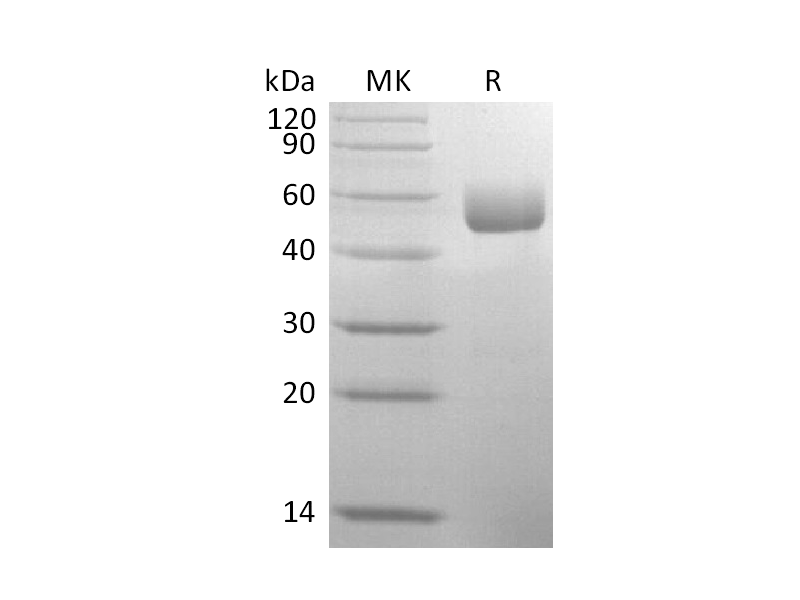 Recombinant Mouse Serpin A1a (C-6His, AAH11040.1 )