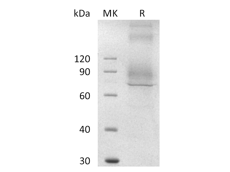Recombinant Mouse NaPi2b (C-Flag)