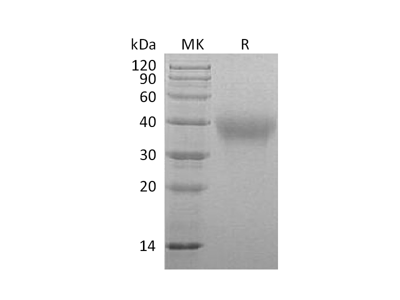 Recombinant Marmoset TIM-3 (C-6His)