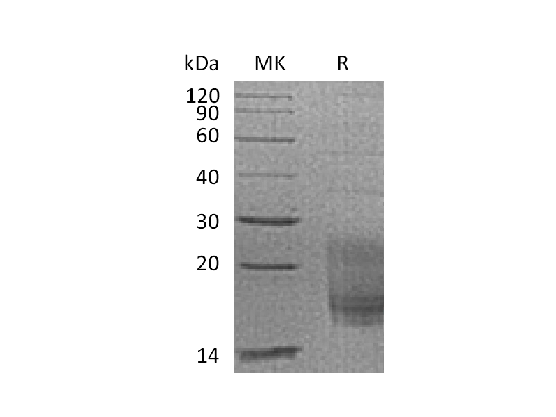 Recombinant Cynomolgus TIGIT (C-6His)
