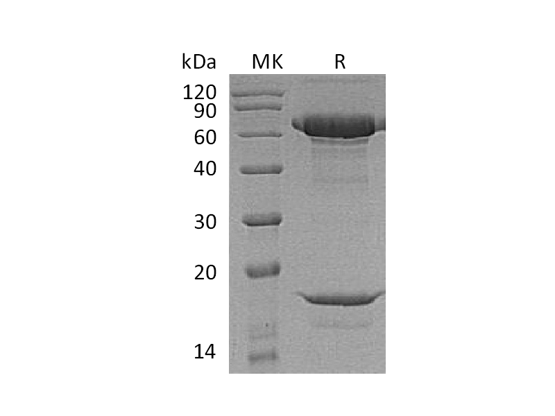 Recombinant Macaca nemestrina PCSK9 (C-6His)