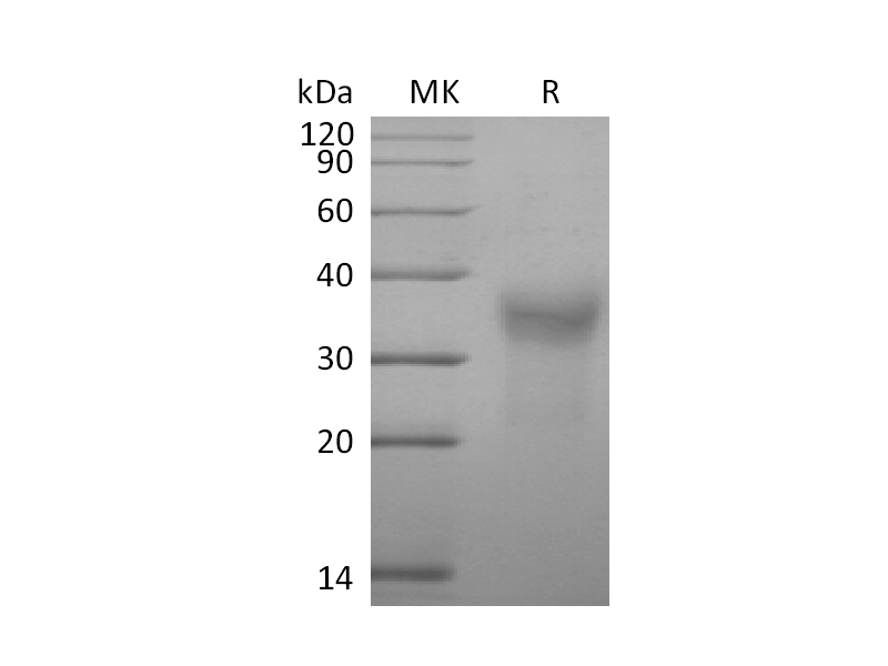 Recombinant Cynomolgus CD7 (C-6His)