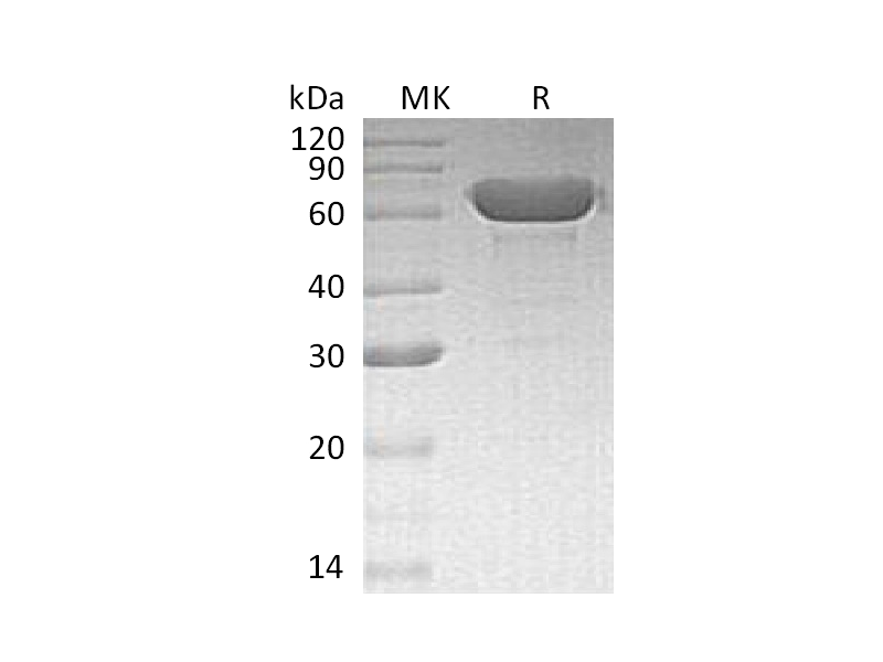 Recombinant Human Albumin