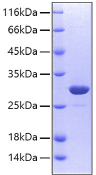 Recombinant Human Carbonic anhydrase 2 Protein