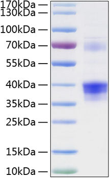 Recombinant Human Clusterin/Apo-J/CLU Protein