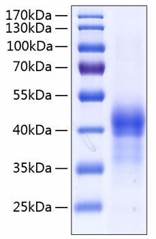 Recombinant Human Lung surfactant protein D/SFTPD(E22G) Protein