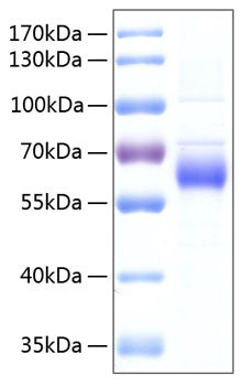 Recombinant Human FGFR-5/FGFRL1 Protein