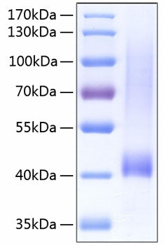 Recombinant Human Biglycan/BGN Protein