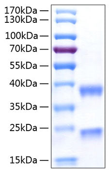 Recombinant Human Complement C1r subcomponent Protein