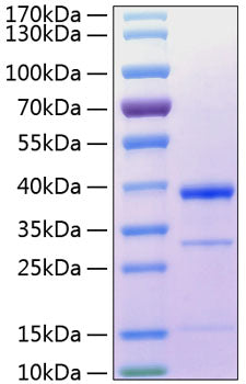 Recombinant Human Cathepsin S Protein