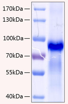 Recombinant Human Progranulin/PGRN/GRN Protein