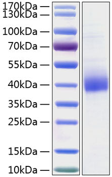 Recombinant Human CD301 Protein