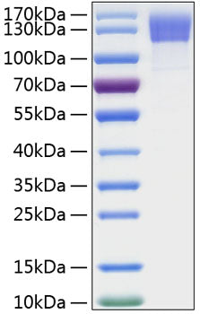 Recombinant Human OSMR/IL-31RB Protein