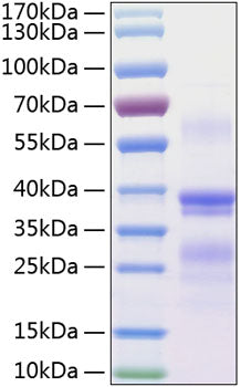 Recombinant Human RGMA Protein