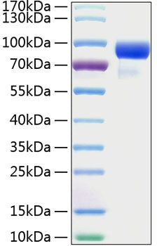 Recombinant Human Hedgehog-interacting protein/HHIP Protein