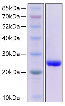 Recombinant Human Serum Amyloid P/SAP Protein