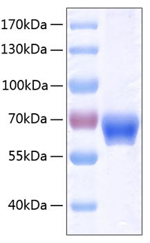 Recombinant Human Ephrin-B1/EFNB1 Protein