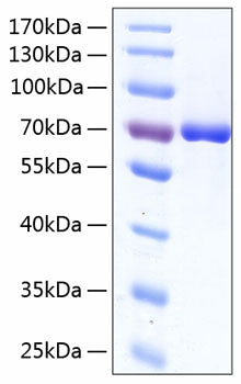 Recombinant Human Serum albumin/ALB Protein